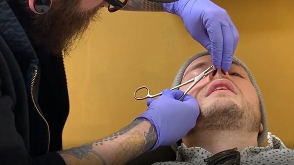 Piercing Experience: Nick's Nose Ring Resize