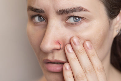 Unfiltered with Kyra: Why is your piercing still irritated?