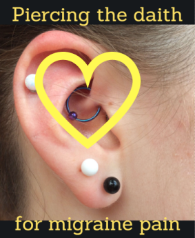 “On Pins and Needles” - Acupuncture and the Daith Piercing for Migraine Pain (and more!)