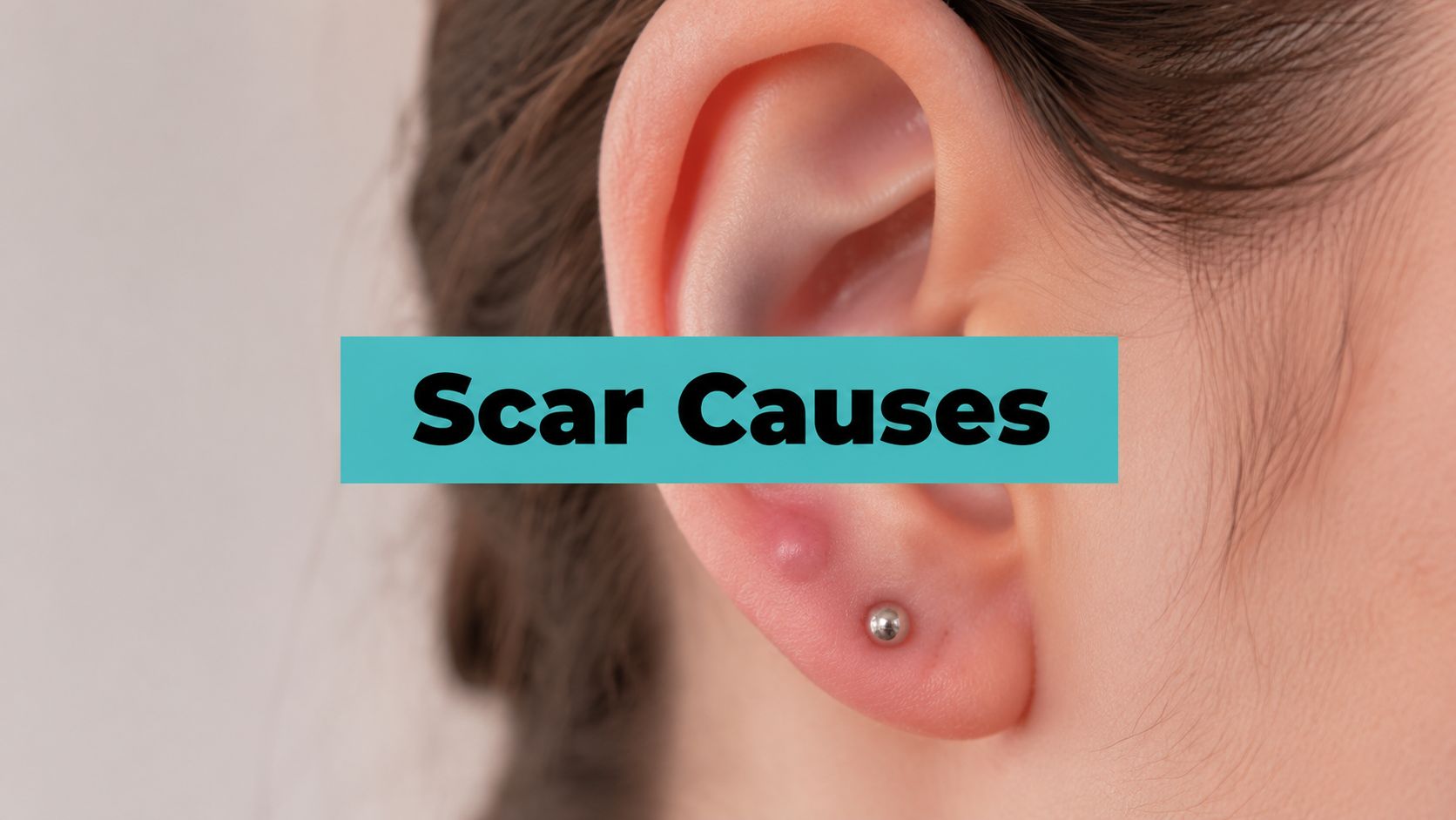 What Causes Hypertrophic Scars? Your Piercing Guide